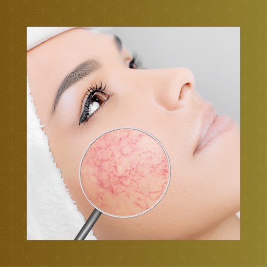 Viso - Trattamento SENSITIVE