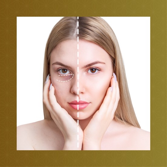 Viso - Trattamento COLLAGEN